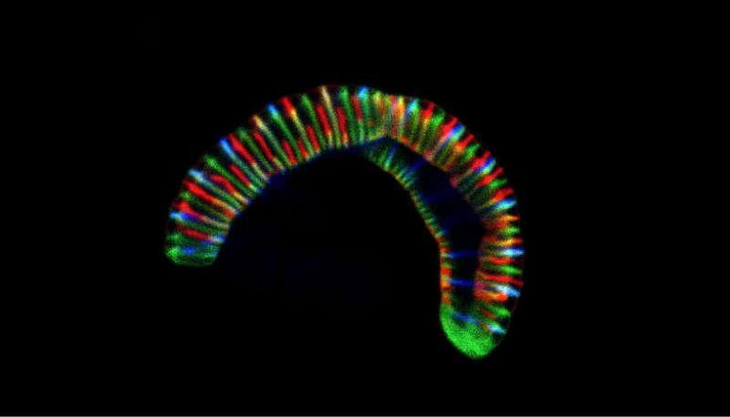 Caterpillar-like bacteria crawling in our mouths