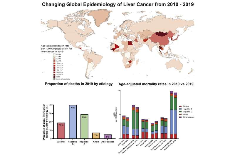 علل سرطان کبد در سراسر جهان در حال تغییر است: برخی بالا، برخی پایین