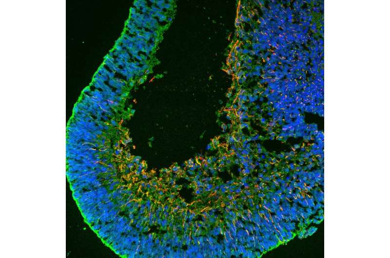 همجوشی سلولی پتانسیل بازسازی شبکیه انسان را 