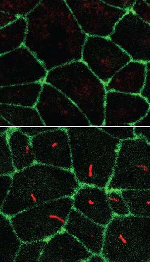 Cilia-free stem cells offer new path to study rare diseases
