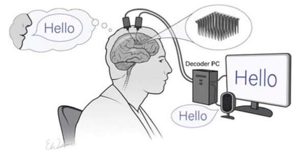 Clinical trial aims to develop new methods to restore speech with brain-computer interface