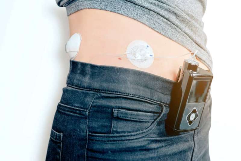 Clinical trial shows bionic pancreas improves type 1 diabetes management compared to standard insulin delivery method
