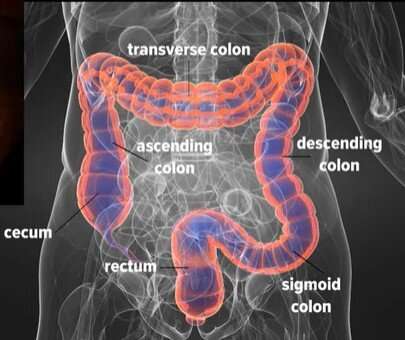Colonoscopy is the most comprehensive screening for colorectal cancer, despite flawed interpretations of a new study