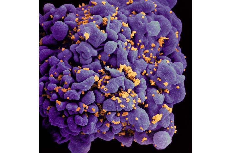 تزریق ترکیبی آنتی بادی ضد HIV ویروس را برای مدت طولانی سرکوب می کند