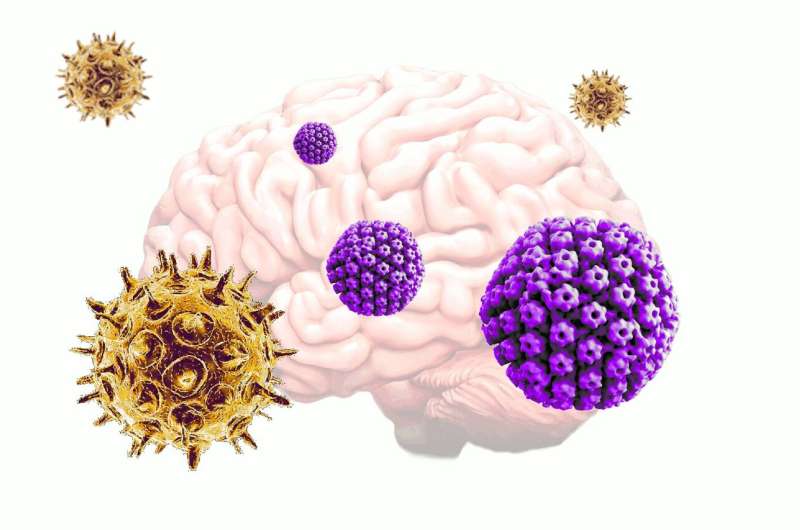 Common viruses may be triggering the onset of Alzheimer's disease