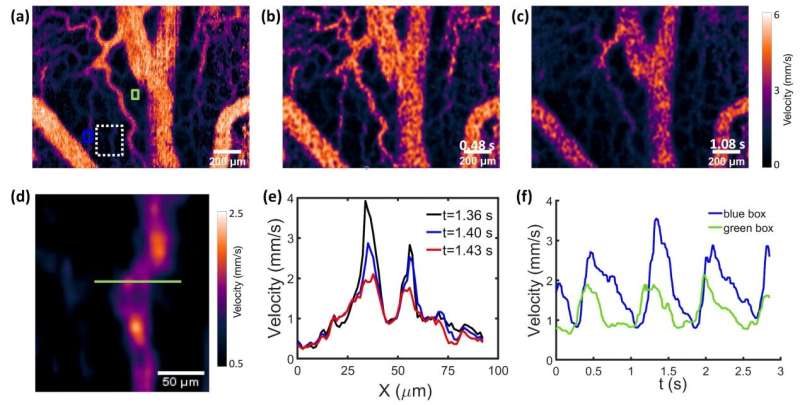 Confocal laser speckle autocorrelation imaging of dynamic flow in microvasculature