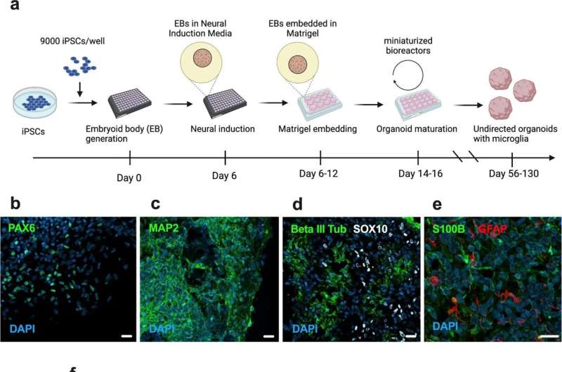 COVID-19 linked to excessive destruction of connections between nerve cells in new brain model