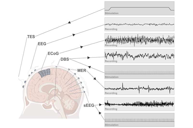 Deep brain machine interfaces - interacting with human deep brain