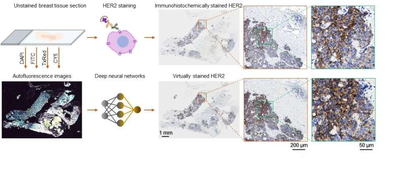Deep learning-based virtual staining of tissue facilitates rapid assessment of breast cancer biomarker