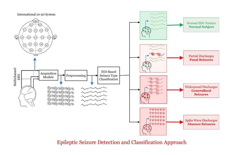 Detecting seizures and interpreting EEGs, the direct algorithmic way