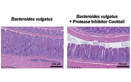 شماره 2 رقمی شده: نمونه های مدفوع آنزیم میکروبی را نشان می دهد که باعث بیماری روده می شود