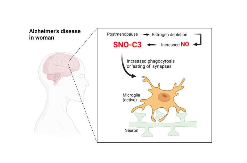 Discovery could explain why women are more likely to get Alzheimer's