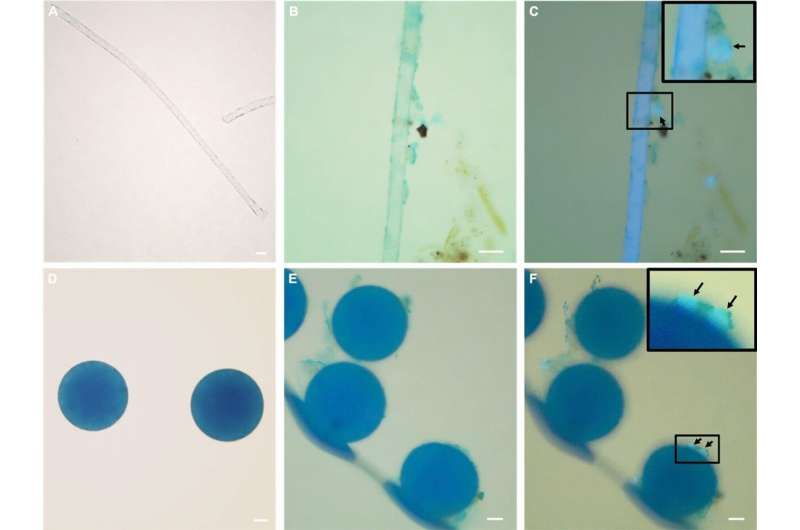 Disease-causing parasites can hitch a ride on plastics and potentially spread through the sea