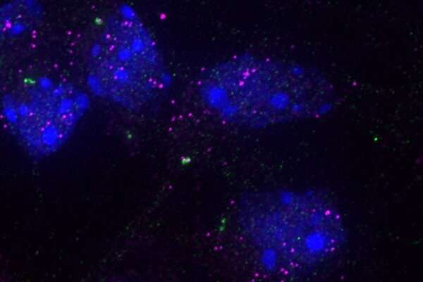 Diversity of centrosomes delivers new clues for neurological diseases