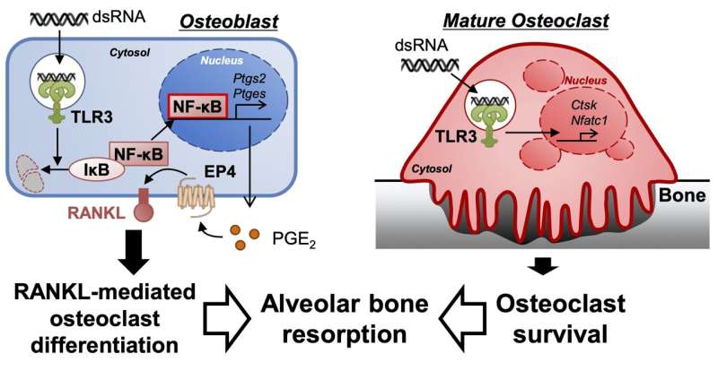 Double-stranded RNA induces bone loss during gum disease