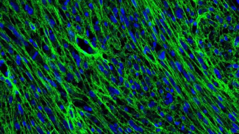 Dynamic cells linked to brain tumor growth and recurrence