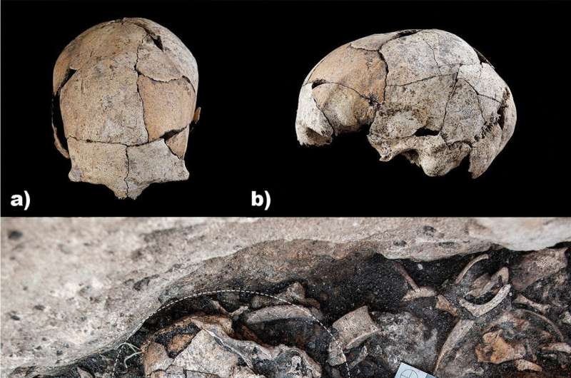 Earliest evidence of ear surgery 5,300 years ago