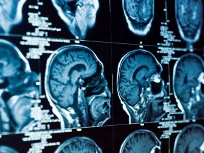 Early posttraumatic seizures tied to worse traumatic brain injury outcomes