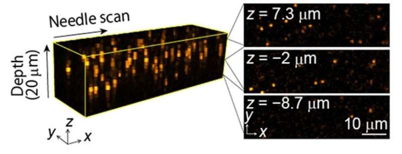 تتيح موجات الضوء المهندسة التسجيل السريع لصور المجهر ثلاثي الأبعاد