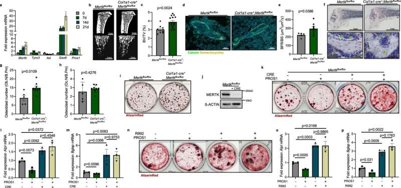 Enzyme inhibition promotes bone formation and curbs the development of bone metastases