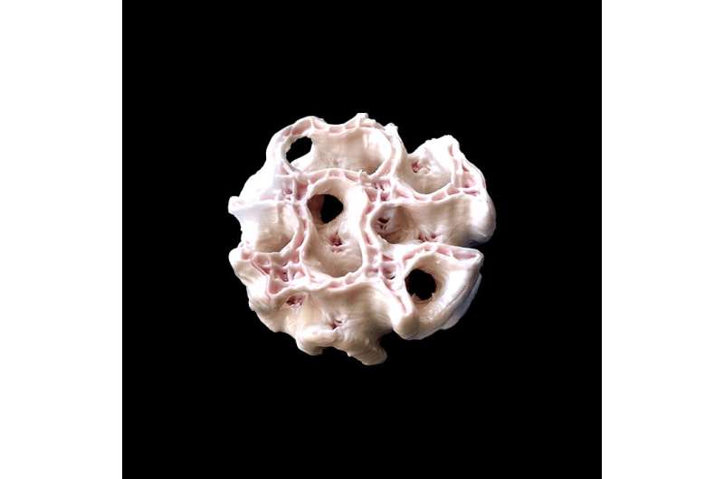 ESA - 3D-printed bone