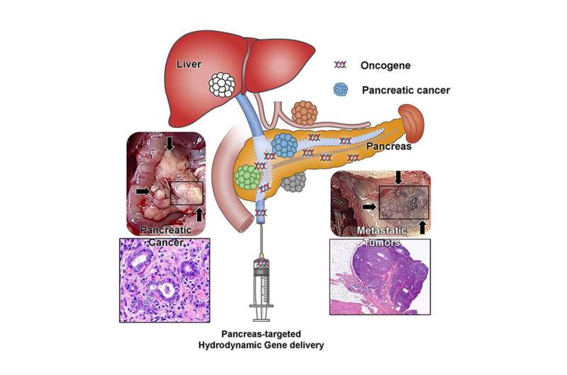 Establishment of a pancreatic cancer animal model using the pancreas-targeted hydrodynamic gene delivery method