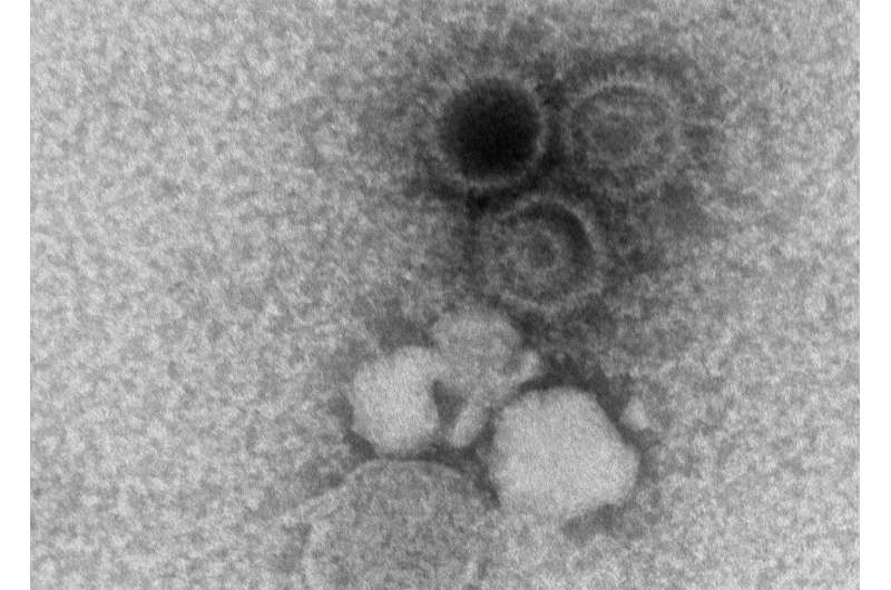 Experimental monoclonal antibodies show promise against Epstein-Barr virus