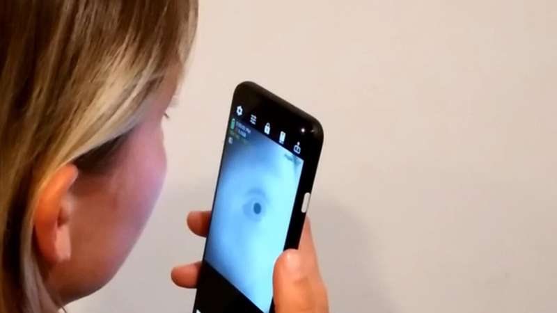 'Eye-catching' smartphone app could make it easy to screen for neurological disease at home
