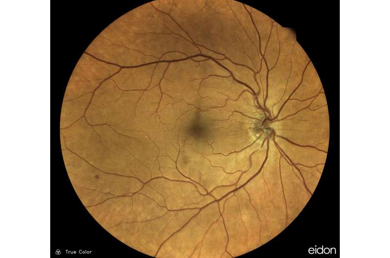 Eye provides clues to insidious vascular disease
