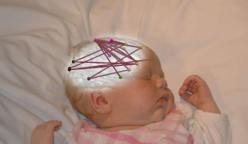 Fetal exposure to drugs may affect infants' brain development