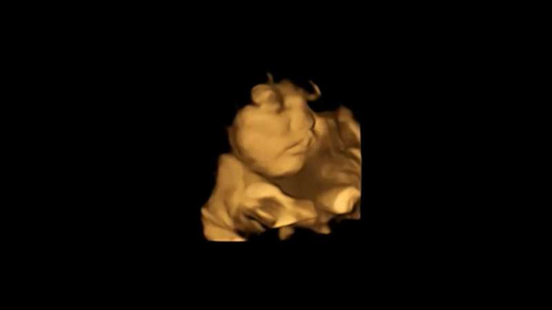 First direct evidence that babies react to taste and smell in the womb