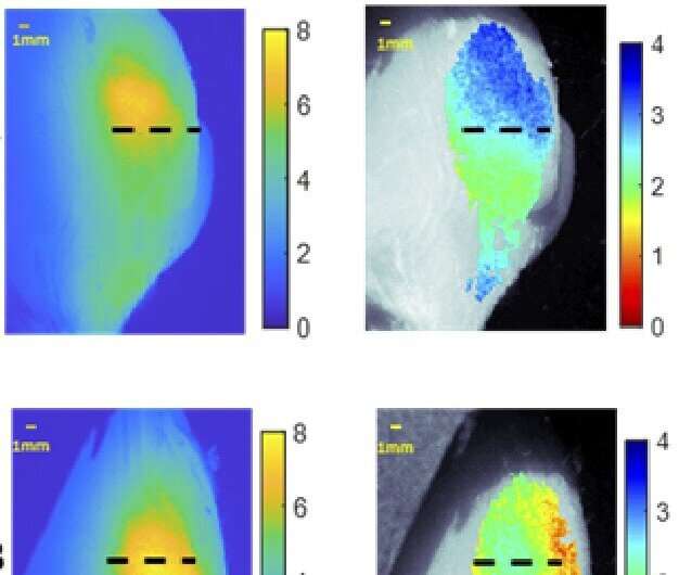 Fluorescence imaging system lays groundwork for better tumor removal