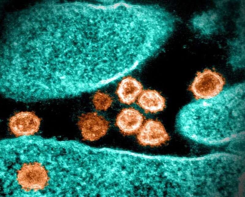 آلرژی غذایی با خطر کمتر عفونت SARS-CoV-2 مرتبط است
