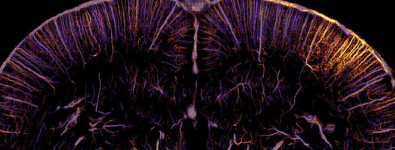 Functional ultrasound microscopy: sensing the whole brain neuronal activity at the micron scale