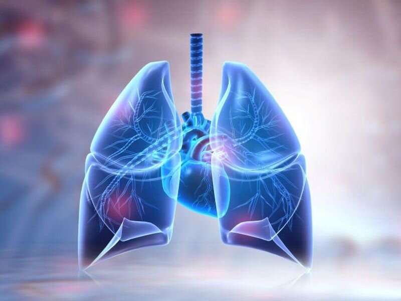 Doença do refluxo gastroesofágico causalmente ligada ao câncer de pulmão