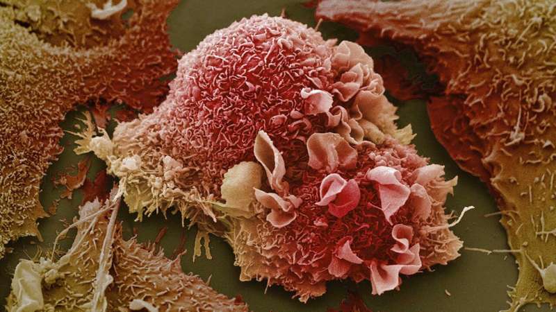 سخت گرفتن در مورد سرطان ریه سلول تافت