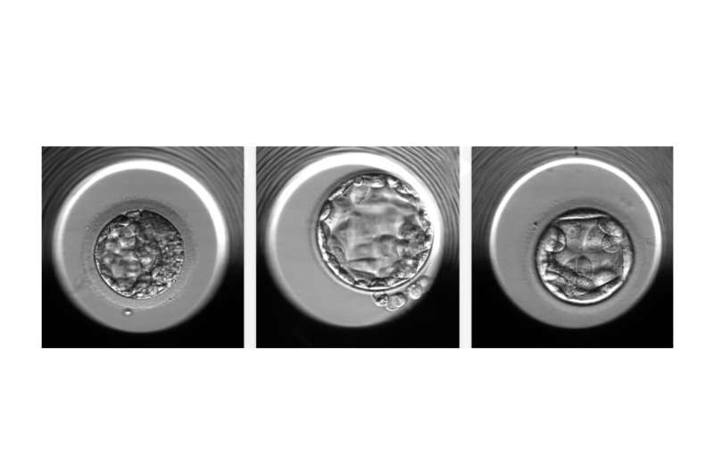 Harnessing artificial intelligence technology for IVF embryo selection