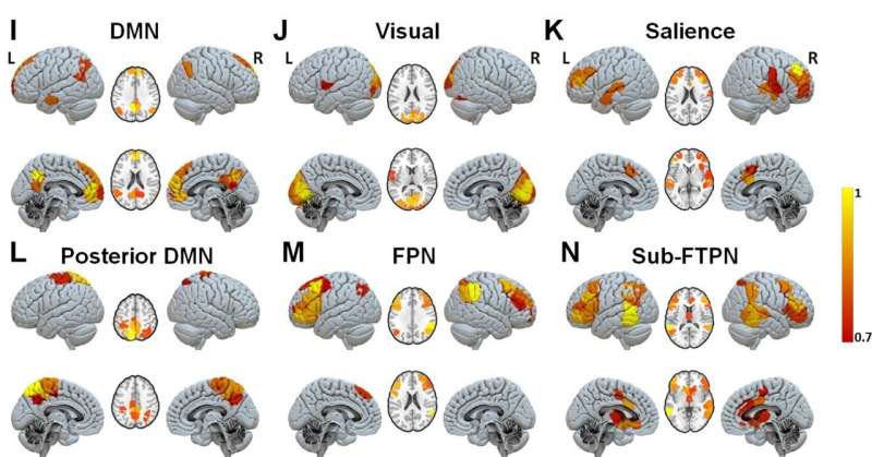 HBP study explores mechanisms that underlie disorders of consciousness