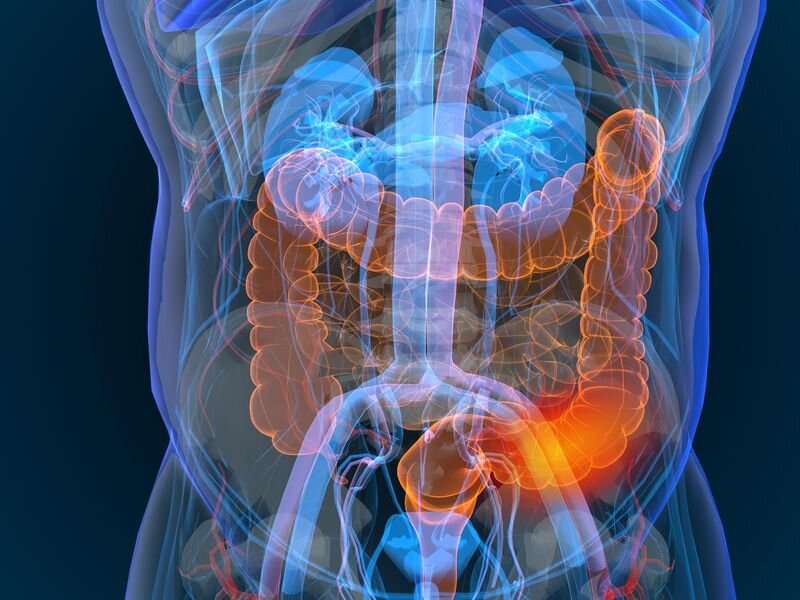 Heavy antibiotic use tied to development of crohn's, colitis