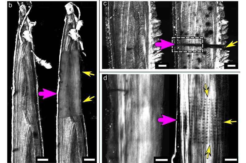 High-energy X-rays leave a trace of destruction in bone collagen
