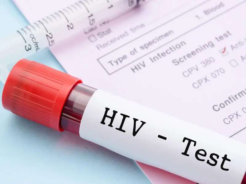 HIV testing plummeted during pandemic