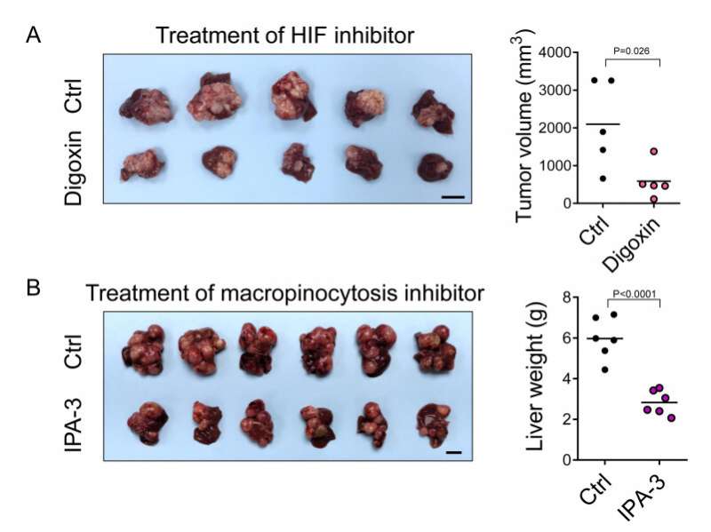 HKUMed discovers a new metabolic route for liver cancer paving the way for new therapeutic opportunities - Press Releases - Medi