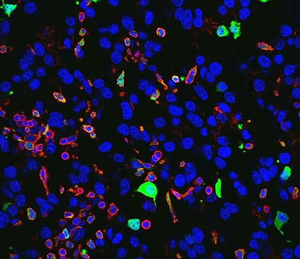 Houston Methodist researchers identify an immunotherapy target to combat glioblastomas