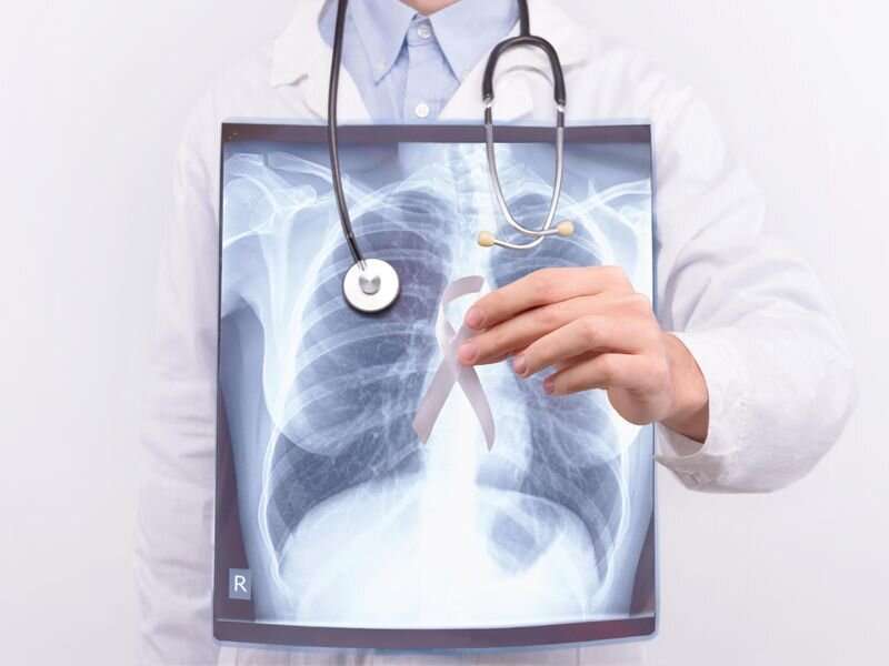 How dangerous is it for lung cancer patients to skip radiation treatments?