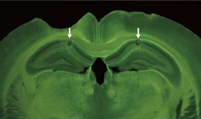 老鼠大脑的左右海马CA1区域是如何相互交流的