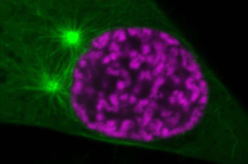 How the genome is packed into chromosomes that can be faithfully moved during cell division
