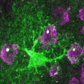 Huntington's disease — astrocytes to the rescue