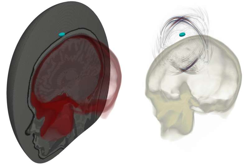 Imaging the brain with ultrasound waves