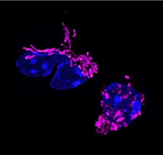 Immune function remodeled by mitochondrial shape