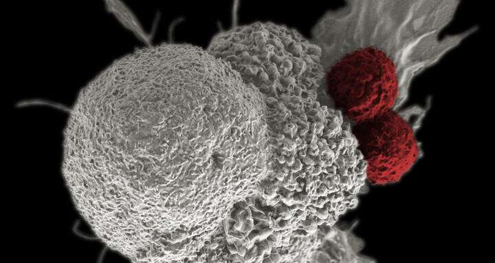 Immunotherapy may get a boost
